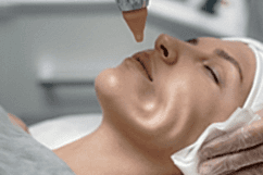 скидка-skinhale