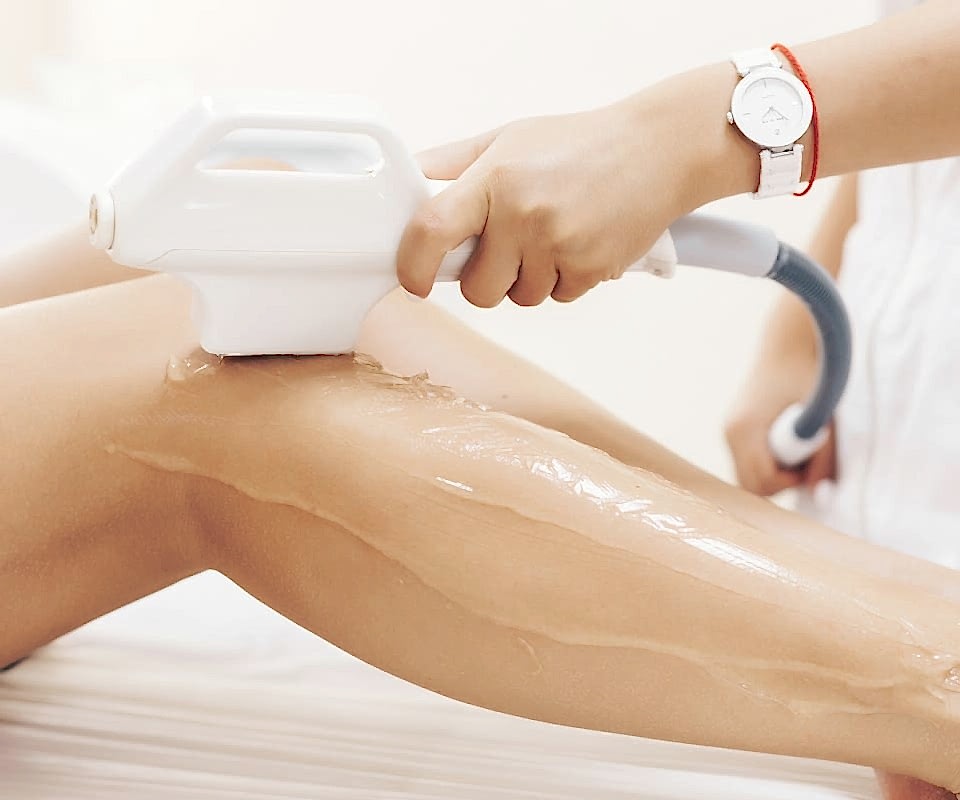 Фотоэпиляция всего тела